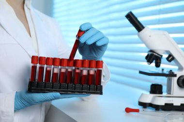Laboratuvar testi. Doktor test tüpünü askıdan kan örneği alarak kapalı alanda, yakın plan