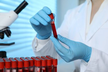Laboratuvar testi. Doktor elinde kan örneğiyle test tüpü tutuyor, yakın plan.