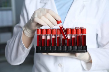Laboratuvar testi. Doktor elinde kan örnekleri olan test tüpleri tutuyor, yakın plan.
