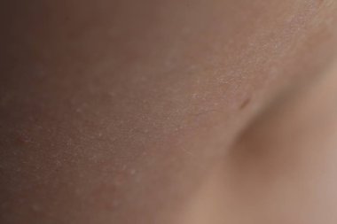 Arkaplan olarak kuru cildin dokusu, yakın plan