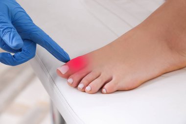 Eklem iltihabı. Doktor hastanede kadının ayağını kontrol ediyor, yakın plan.