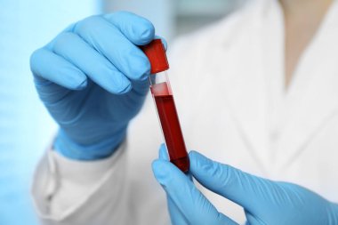 Laboratuvar testi. Doktor elinde kan örneğiyle test tüpü tutuyor, yakın plan.