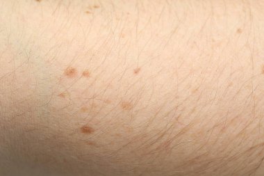 Arka plan olarak normal cilt dokusu, yakın plan