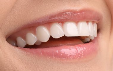 Sağlıklı dişler ve güzel gülümseme, closeup olan kadın