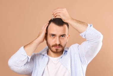 Kellik tedavisi. Adam bej arka plandaki saçlara serum uyguluyor.