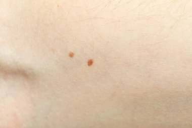 Arka plan olarak normal cilt dokusu, yakın plan