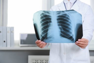 Doktor klinikteki ayak röntgenini inceliyor, yakın plan. Metin için boşluk