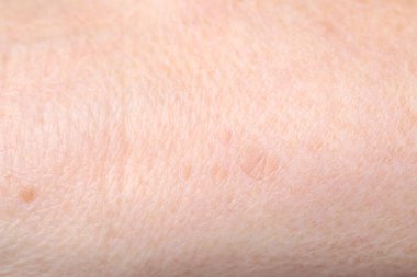 Arka planda doğum lekeleri olan cildin makro görünümü