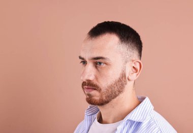 Kellik sorunu. Koyu bej arkaplanda saç çizgisi olan adam, metin için boşluk