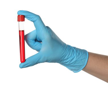 Tıbbi eldivenli doktor, elinde beyaz arka planda kan örneği olan test tüpü tutuyor.