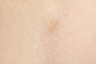 Arka plan olarak sağlıklı cilt dokusu, yakın plan