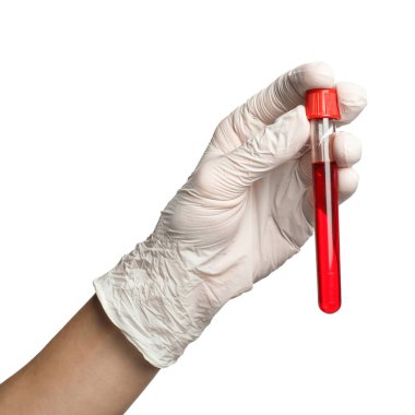 Tıbbi eldivenli doktor, elinde beyaz arka planda kan örneği olan test tüpü tutuyor.