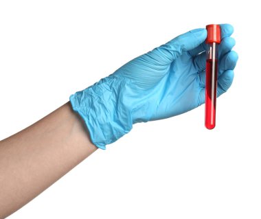 Tıbbi eldivenli doktor, elinde beyaz arka planda kan örneği olan test tüpü tutuyor.