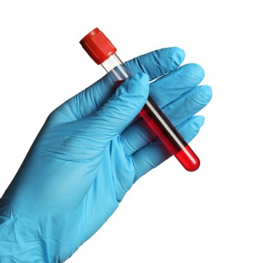 Tıbbi eldivenli doktor, elinde beyaz arka planda kan örneği olan test tüpü tutuyor.