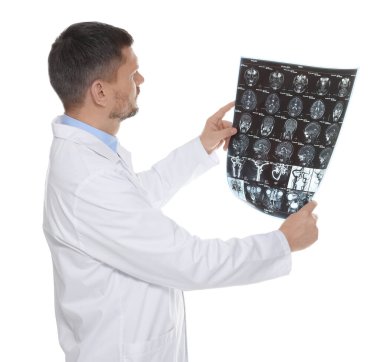 Doktor, beyaz arka planda klinikte beyin MR taraması yapıyor.