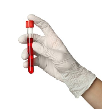Tıbbi eldivenli doktor, elinde beyaz arka planda kan örneği olan test tüpü tutuyor.