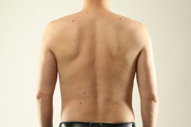 Derisinde benler olan bir adam arka planda ışığa karşı, yakın plan