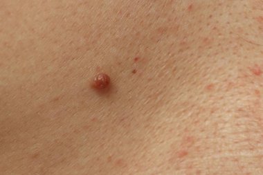 Derisinde ben olan adam, yakın plan.