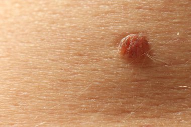 Derisinde ben olan adam, yakın plan.