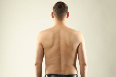 Derisinde benler olan bir adam arka planda, açık arkaplanda