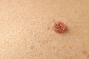 Derisinde ben olan adam, yakın plan.