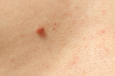 Derisinde ben olan adam, yakın plan.