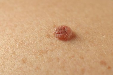 Derisinde ben olan adam, yakın plan.