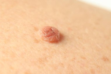 Derisinde ben olan adam, yakın plan.