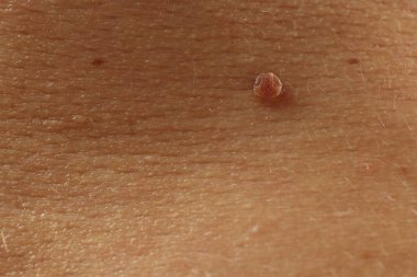 Derisinde ben olan adam, yakın plan.