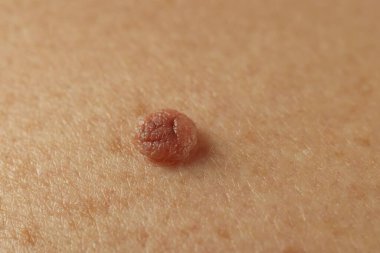 Derisinde ben olan adam, yakın plan.