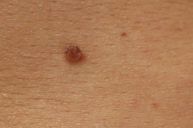 Derisinde ben olan adam, yakın plan.