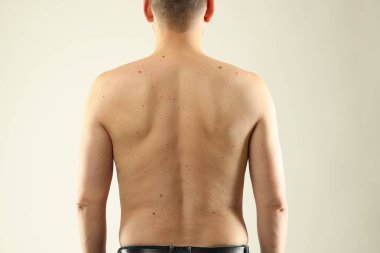 Derisinde benler olan bir adam arka planda ışığa karşı, yakın plan