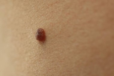 Derisinde ben olan adam, yakın plan.