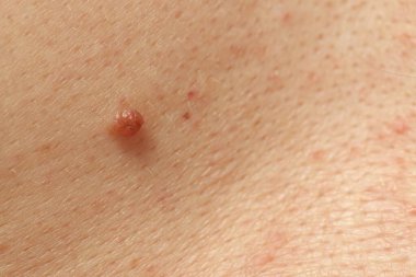 Derisinde ben olan adam, yakın plan.