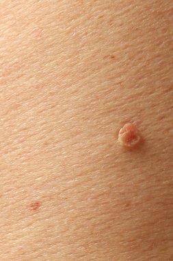 Derisinde ben olan adam, yakın plan.