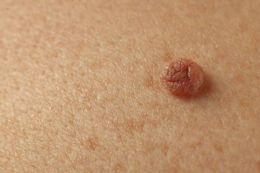 Derisinde ben olan adam, yakın plan.