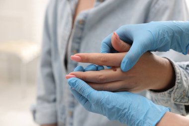 Hastanede kadının köstebeklerini inceleyen doktor, yakın plan.