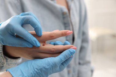 Hastanede kadının köstebeklerini inceleyen doktor, yakın plan.