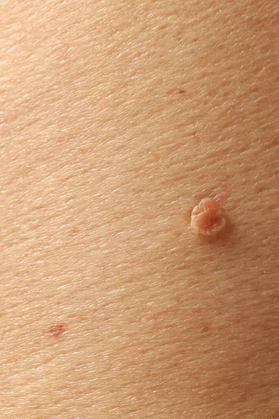 Derisinde ben olan adam, yakın plan.