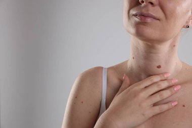 Vücudunda benler olan bir kadın, arka planda ışığa karşı, yakın plan. Metin için boşluk