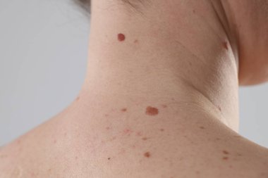 Vücudunda benler olan kadın arka planda ışığa karşı, yakın plan