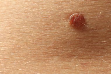 Derisinde ben olan adam, yakın plan.