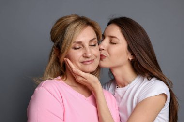 Annesini yanağından öpen bir kadın var.