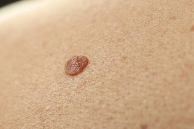 Derisinde ben olan adam, yakın plan.