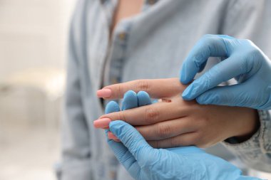 Hastanede kadının köstebeklerini inceleyen doktor, yakın plan.