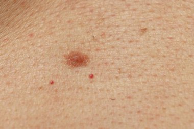 Derisinde ben olan adam, yakın plan.