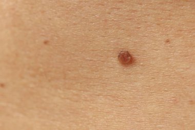 Derisinde ben olan adam, yakın plan.