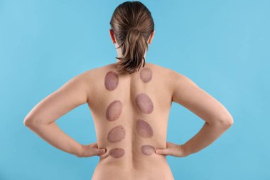 Açık mavi arka planda terapi sonrası kadın, arka plan