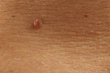 Derisinde ben olan adam, yakın plan.