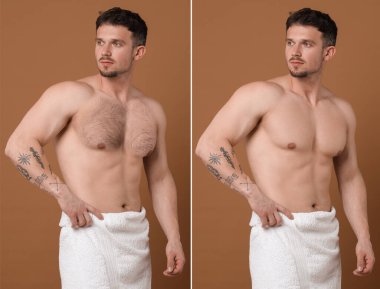 Epilasyon öncesi ve sonrası. Kahverengi arka planda göğüs gösteren adam, kolaj.